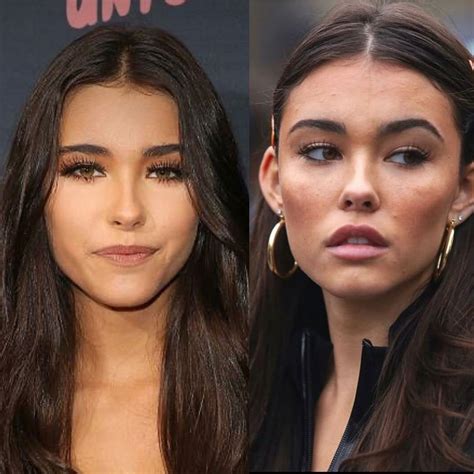 madison beer plastic surgery|Madison Beer Denies Plastic Surgery Rumors, But Heres What。